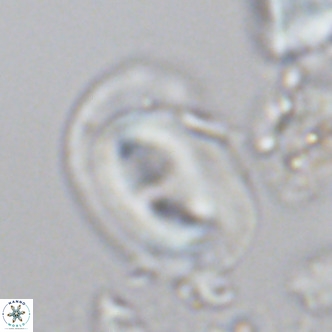 Helicosphaera carteri carteri VR 04569