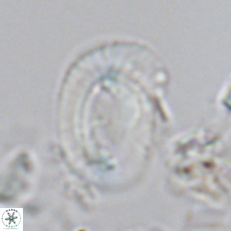 Helicosphaera carteri carteri VR 04571
