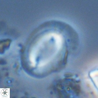 Helicosphaera carteri carteri VR 04573