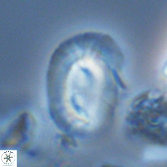 Helicosphaera carteri carteri VR 04575