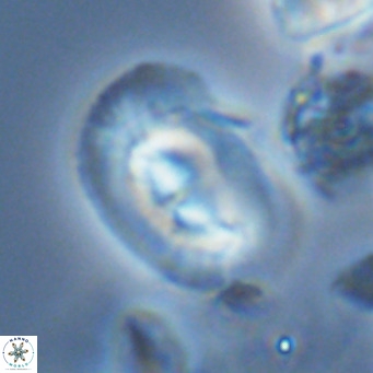 Helicosphaera carteri carteri VR 04576