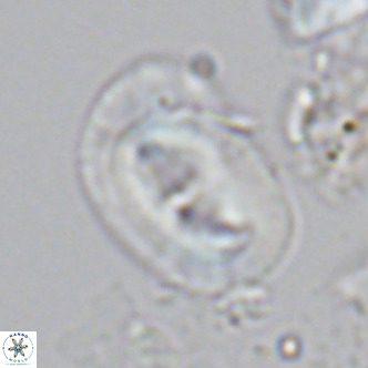 Helicosphaera carteri carteri VR 04577