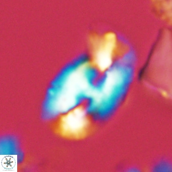Helicosphaera carteri carteri VR 05113