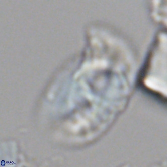 Helicosphaera carteri carteri VR 05114