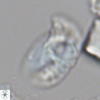 Helicosphaera carteri carteri VR 05114