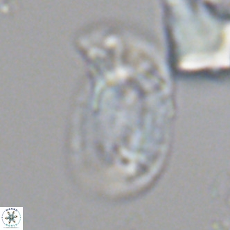 Helicosphaera carteri carteri VR 05116