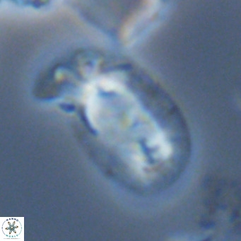 Helicosphaera carteri carteri VR 05121