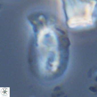 Helicosphaera carteri carteri VR 05122