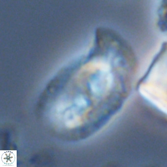 Helicosphaera carteri carteri VR 05123