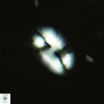 Helicosphaera carteri epimikeisporous VR 07689