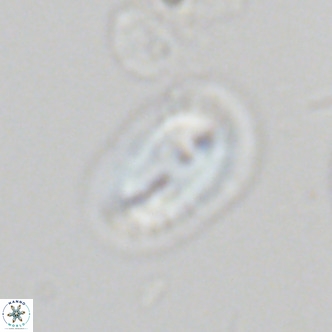 Helicosphaera carteri epimikeisporous VR 07695