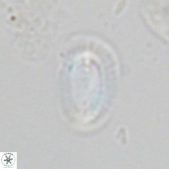 Helicosphaera carteri epimikeisporous VR 07696