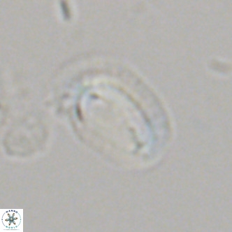 Helicosphaera carteri epimikeisporous VR 07697