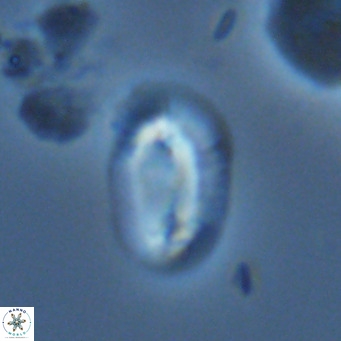 Helicosphaera carteri epimikeisporous VR 07699