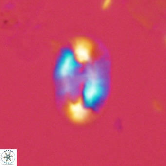 Helicosphaera carteri epimikeisporous VR 07691
