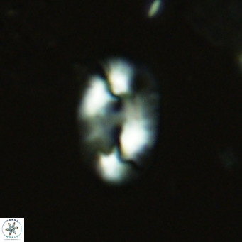 Helicosphaera carteri epimikeisporous VR 07692