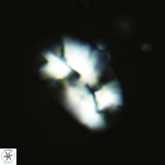 Helicosphaera carteri epimikeisporous VR 07755