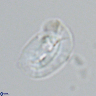 Helicosphaera carteri epimikeisporous VR 07759