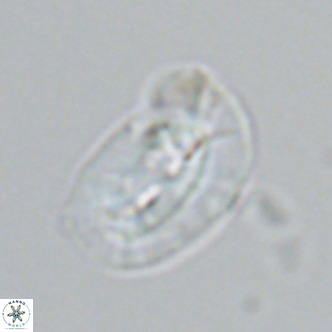 Helicosphaera carteri epimikeisporous VR 07759