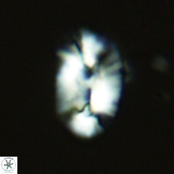 Helicosphaera carteri epimikeisporous VR 07752