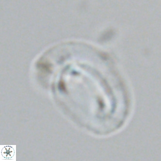 Helicosphaera carteri epimikeisporous VR 07764