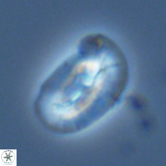 Helicosphaera carteri epimikeisporous VR 07769