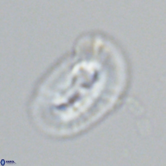 Helicosphaera carteri epimikeisporous VR 07760