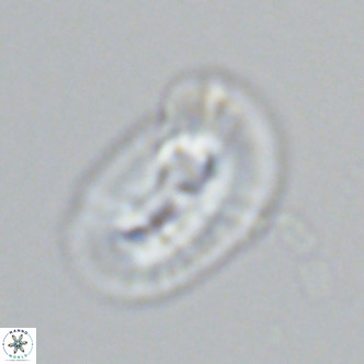 Helicosphaera carteri epimikeisporous VR 07760