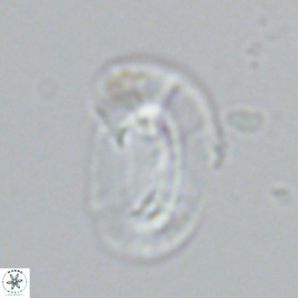 Helicosphaera carteri epimikeisporous VR 07761