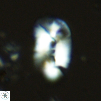 Helicosphaera carteri treisporoi VR 07774