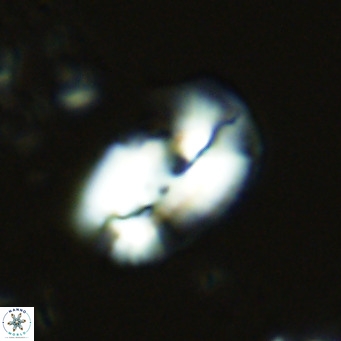 Helicosphaera carteri treisporoi VR 07778