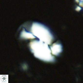 Helicosphaera carteri treisporoi VR 07779