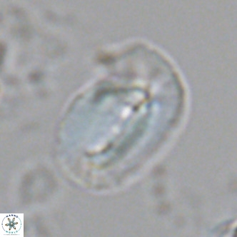 Helicosphaera carteri treisporoi VR 07785