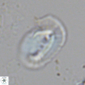 Helicosphaera carteri treisporoi VR 07786