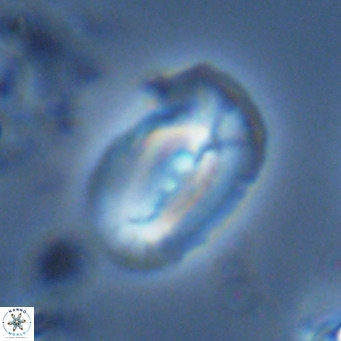 Helicosphaera carteri treisporoi VR 07789