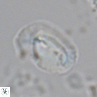 Helicosphaera carteri treisporoi VR 07781