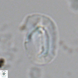 Helicosphaera carteri treisporoi VR 07783