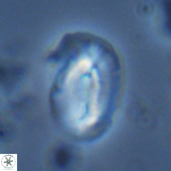 Helicosphaera carteri treisporoi VR 07792