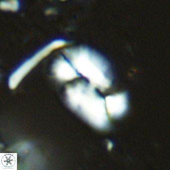 Helicosphaera carteri epimikeisporous VR 08264