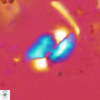 Helicosphaera carteri epimikeisporous VR 08266