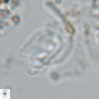 Helicosphaera carteri epimikeisporous VR 08268