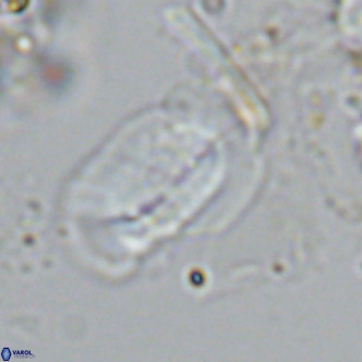 Helicosphaera carteri epimikeisporous VR 08269