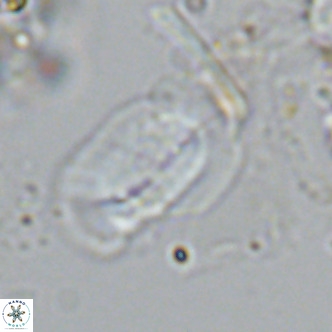 Helicosphaera carteri epimikeisporous VR 08269
