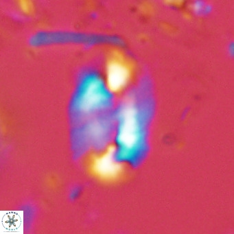 Helicosphaera carteri epimikeisporous VR 08262