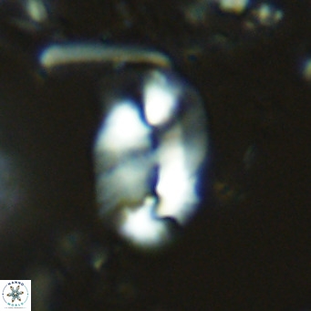Helicosphaera carteri epimikeisporous VR 08263