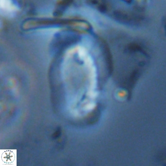 Helicosphaera carteri epimikeisporous VR 08274