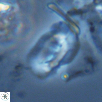 Helicosphaera carteri epimikeisporous VR 08275