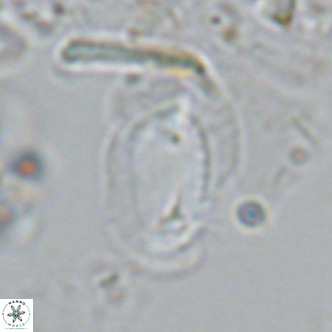 Helicosphaera carteri epimikeisporous VR 08270