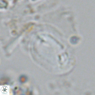 Helicosphaera carteri epimikeisporous VR 08272