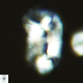 Helicosphaera carteri epimikeisporous VR 09804
